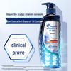 Head & Shoulders Scalp Expert Шампунь против перхоти для контроля жирности