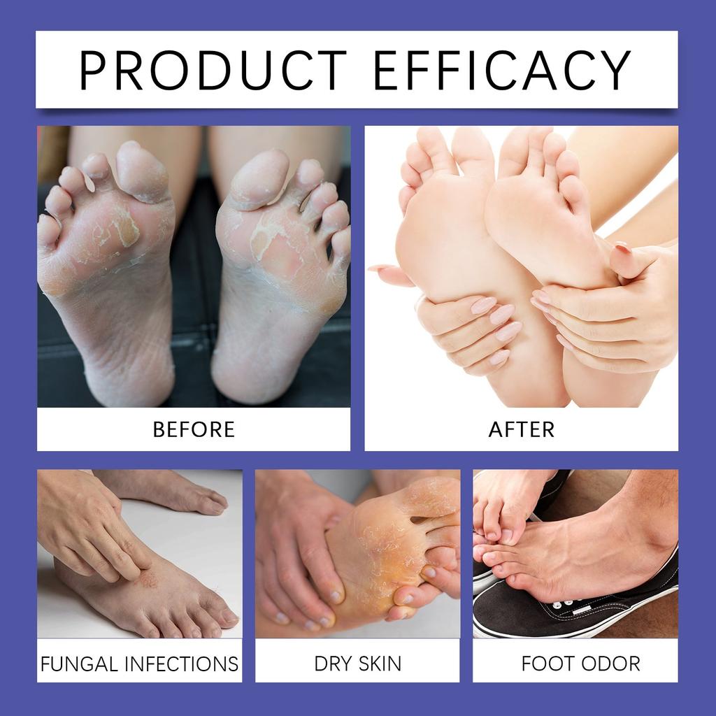 Спрей от запаха ногАнтибактериальный дезодорант-порошокПротив зуда и запаха пота Жидкость для ног спортсменов Противогрибковая обувь Носки Уход за ногами