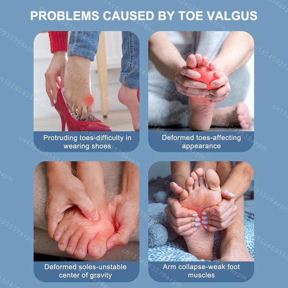 1 шт. ортез для лодыжки, разделитель пальцев ног, шина для выпрямления пальцев ног