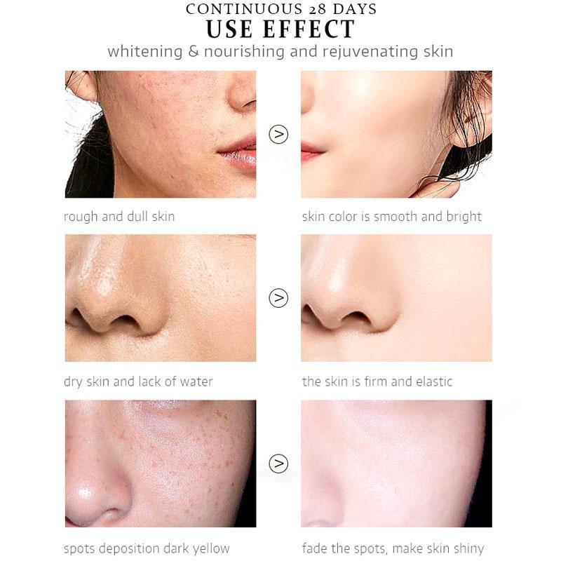 Отбеливающий крем для лица от веснушек, крем для удаления мелазмы, темных пятен, меланин, никотинамид, увлажняющий, осветляющий уход за кожей