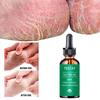 Foot Treatment: Botanical Foot Lotion Moisturizing Foot Care Essence For Dry Skin, Cracked Heels, Strong Healing Power, Antifungal