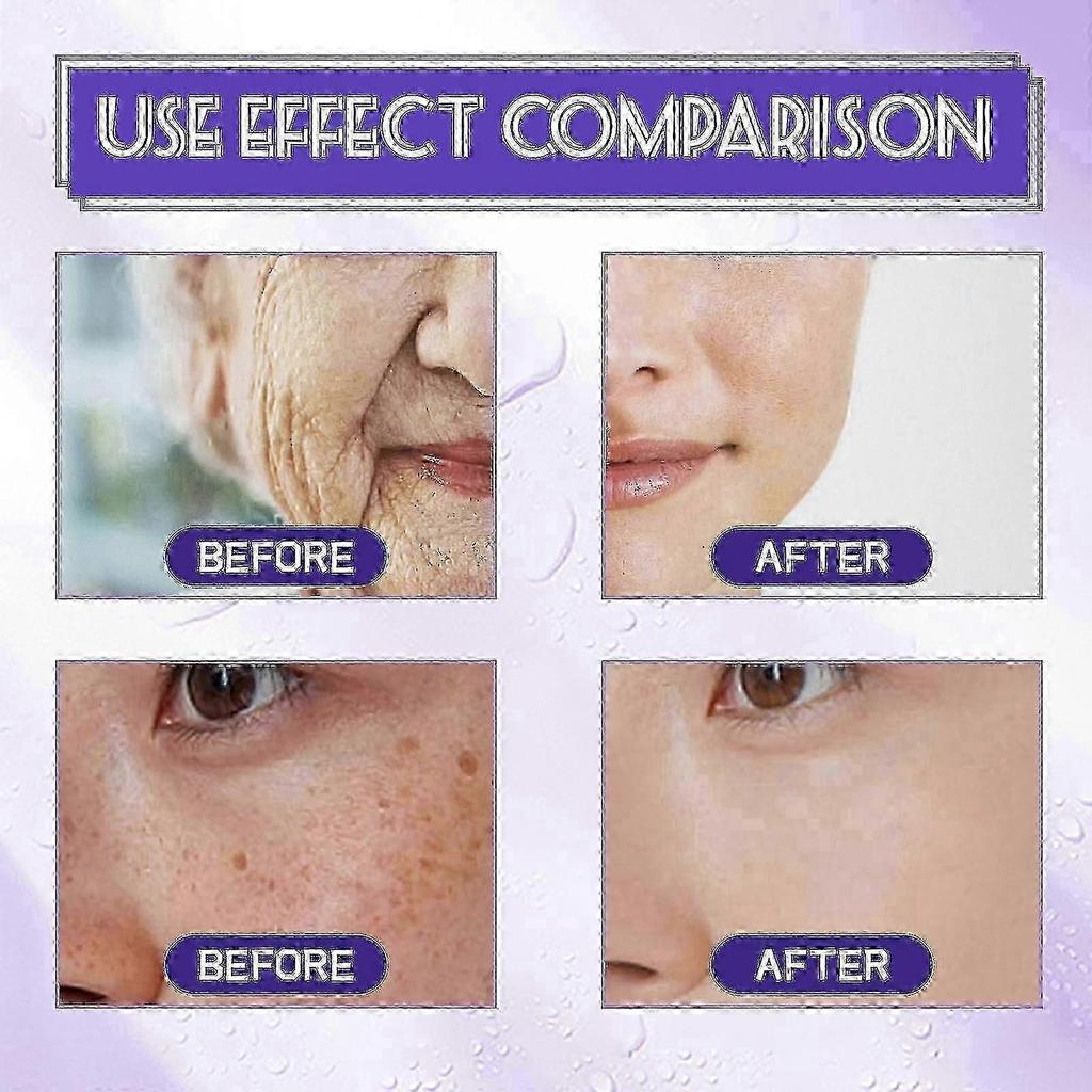 B3 Serum, Dark Spot Corrector B3 Serum With Anti-Aging 10% Niacinamide Discoloration Correcting Serum for Sun Spots, Age Spots