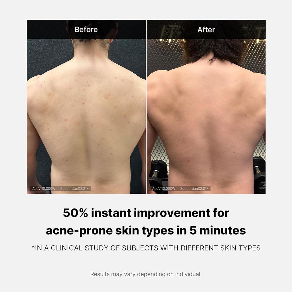 Medicube Red Acne Body Wash 400g | 14.10 Oz