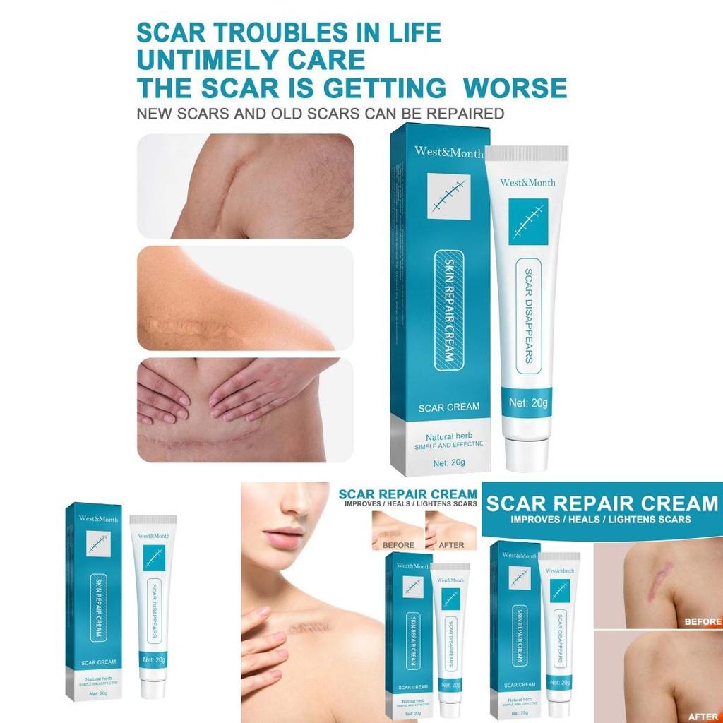 West Month Scar Repair Cream For Reducing Hypertrophic Scars And Pregnancy Marks