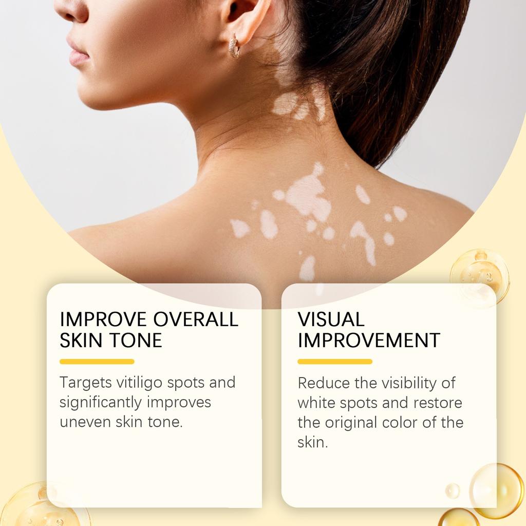 Promote Metabolism, Reduce Inflammation, And Help Reduce The Area Of Spots.help Reduce Pigment In Areas Of Spots.