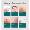 4PCS Acne Blackhead Comedone Removal Needles Black Dots Cleaner Black Head Pore Cleaner