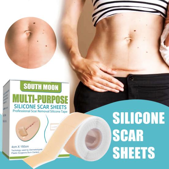 Эффективная наклейка на шрам, умеренный самоклеящийся безопасный силиконовый лист для ремонта шрамов, здравоохранение