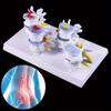 Medical Props Model 1 Set Human Lumbar Lesion Spine Statue Display Model Medical Teaching Learning Tool