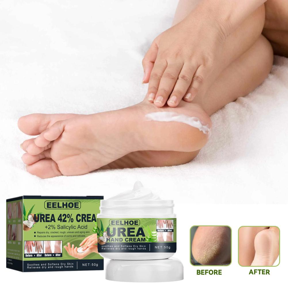 50g Urea Foot Cream Hand Anti Cracking Moisturizing Calluses Dead Skin Repair Rehydration Soften Cuticle Smooth Restore