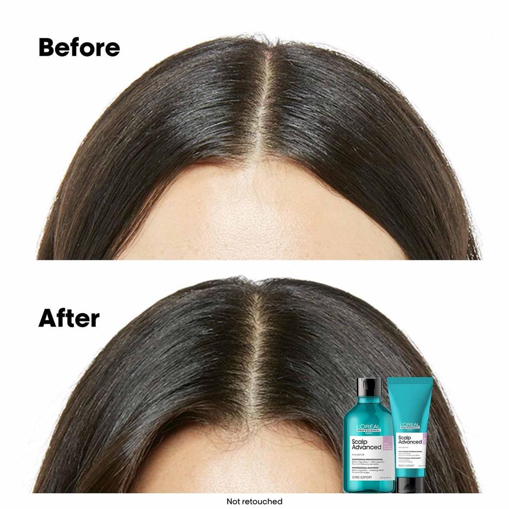 L'Oréal Professional Уход Superior для кожи головы 200 мл: Уход за кожей головы, для чувствительной кожи головы, снимает дискомфорт, увлажняет, легкое покрытие.