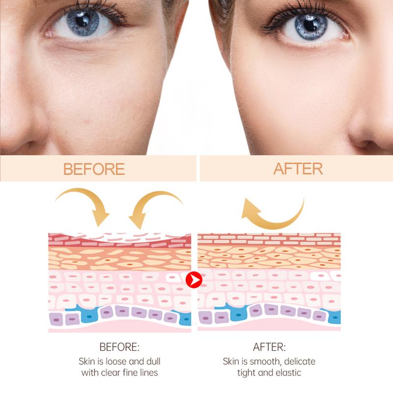 Увлажняющий крем-карандаш против морщин увлажняет и питает кожу, разглаживает мелкие морщинки на лице и шее, осветляет и борется с морщинами.