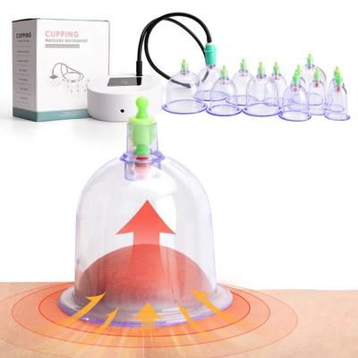 Массаж – Банки