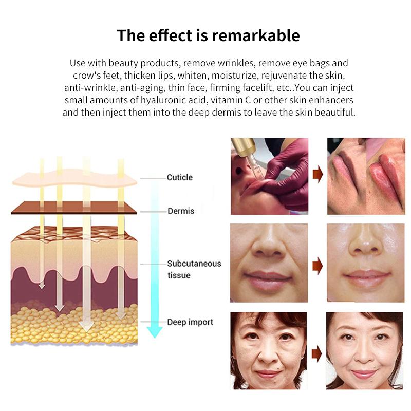 High Pressure Hyaluron Acid Pen Anti Wrinkle Lip Injection Hyaluron Gun Face Atomizer Tattoo Supplies Hyaluron Pen