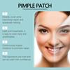 4 формы пластырей от прыщей для лица, покрытия от прыщей, гидроколлоидные пластыри от прыщей, наклейки для покрытия прыщей 240 шт.