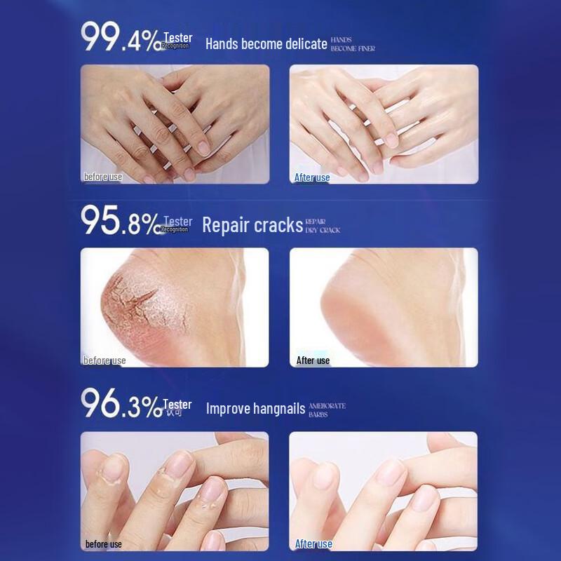 Baili Juren 110 г Глубоко увлажняющий крем со змеиным жиром