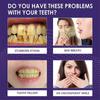 10pcs 4ml V34 Colour Corrector Teeth Whitening Sensitive Teeth Toothpaste Gel Oral Clean Pen