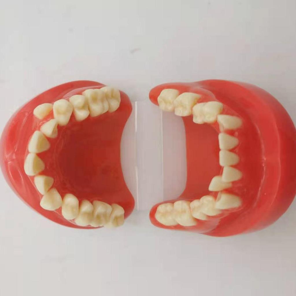 Children's Dental Malocclusion Teaching Model - Red Protrusion