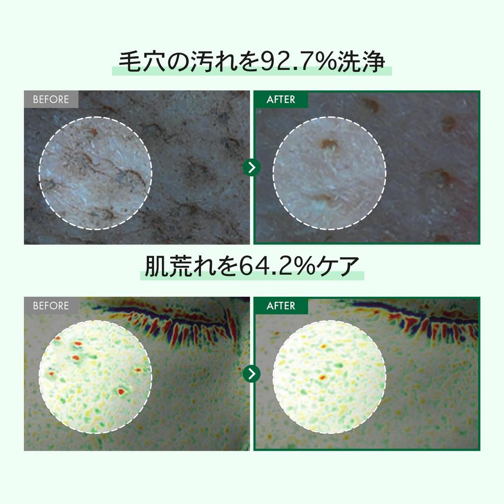 TOSOWOONG Очищающее средство для лица с центеллой азиатской Madagascar Centella 100 мл Очищает макияж Удаляет забитые поры Излишки кожного сала Содержит 9 видов насыщенной корейской косметики по уходу за кожей - Пена,