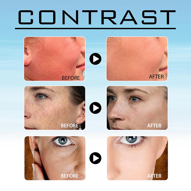 24 шт. УФ-патч для лица, защитные патчи для гольфа, увлажняющие, дышащие, солнцезащитные патчи для лица, для гольфа, пляжа, путешествий