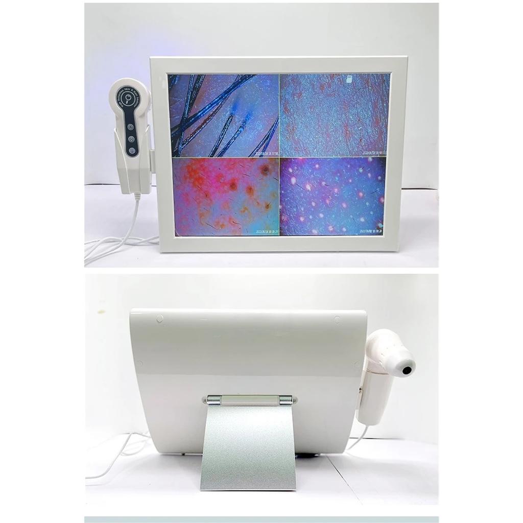 HD Digital Skin Analyzer Professional Hair Scalp Camera Detector Hair Follicle Oil Moisture Test Device 15inch
