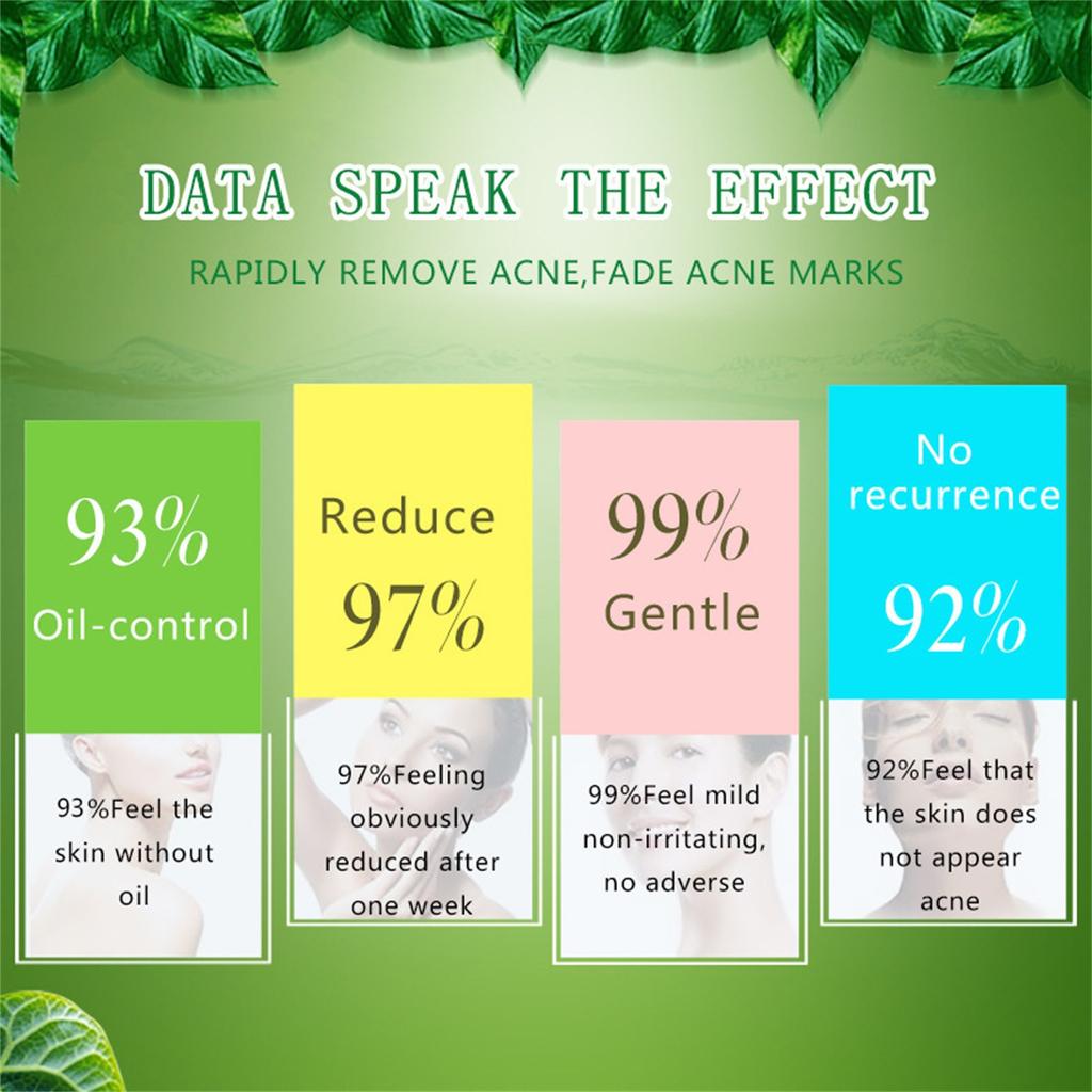 Отбеливающий крем для лица Отбеливающий крем для лица Увлажняющий осветляющий крем для кожи лица Натуральный травяной экстракт 30 мл