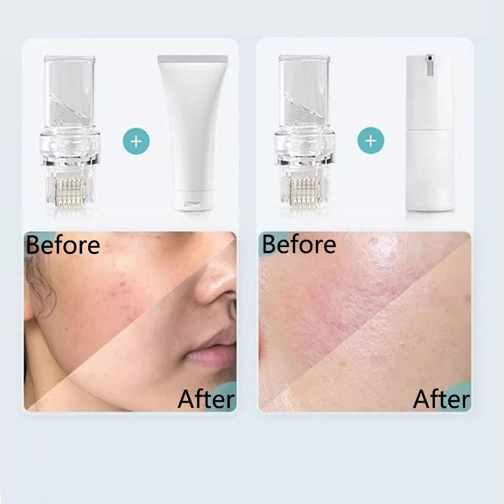 Многоразовый 64-игольный Hydra Roller Микроигольный Hydra Needle Аппликатор сыворотки Домашнее использование