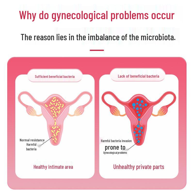 Special ZKBS Women's Probiotic Tablets for Intimate Health and Balance