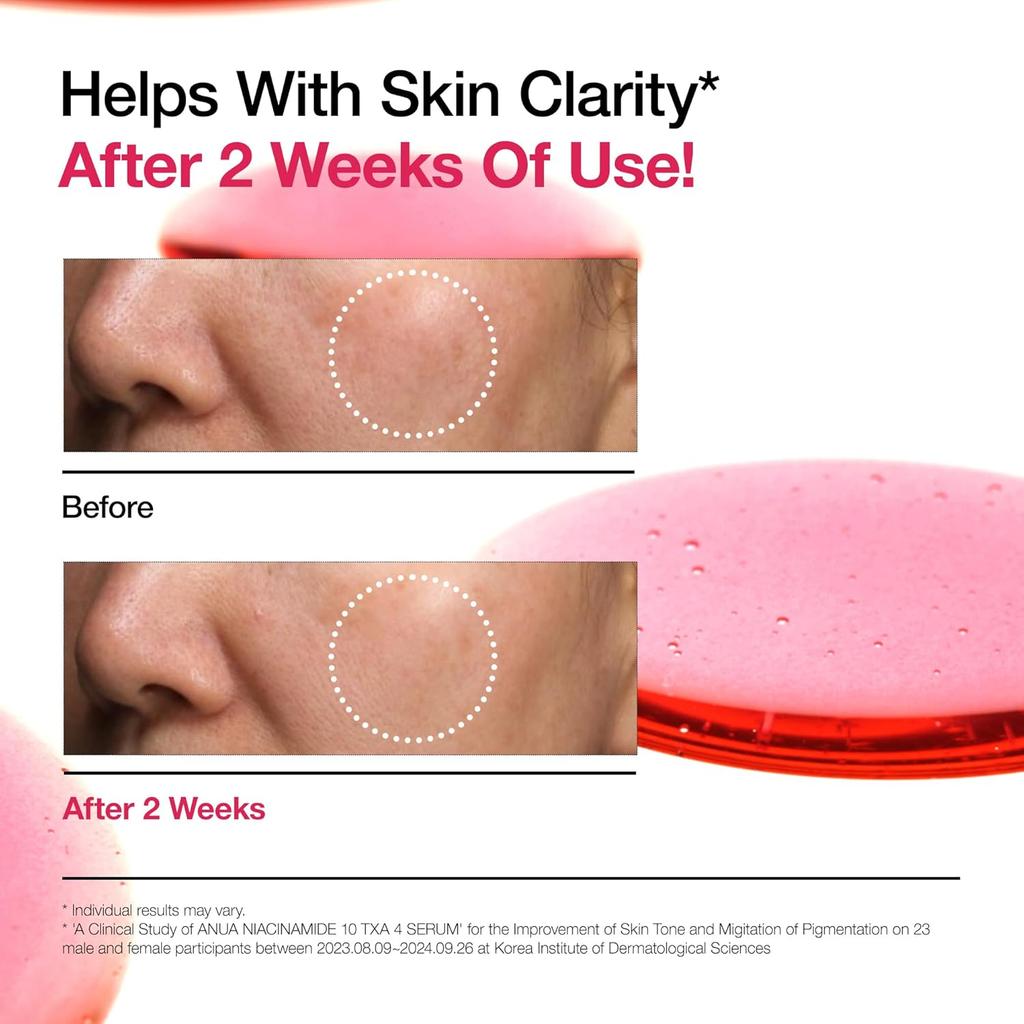 Anua Niacinamide 10 + TXA 4 Brightening Serum 30ml | Glass Skin Korean Facial Serum with Tranexamic Acid, Vitamin B12 & Hyaluronic Acid