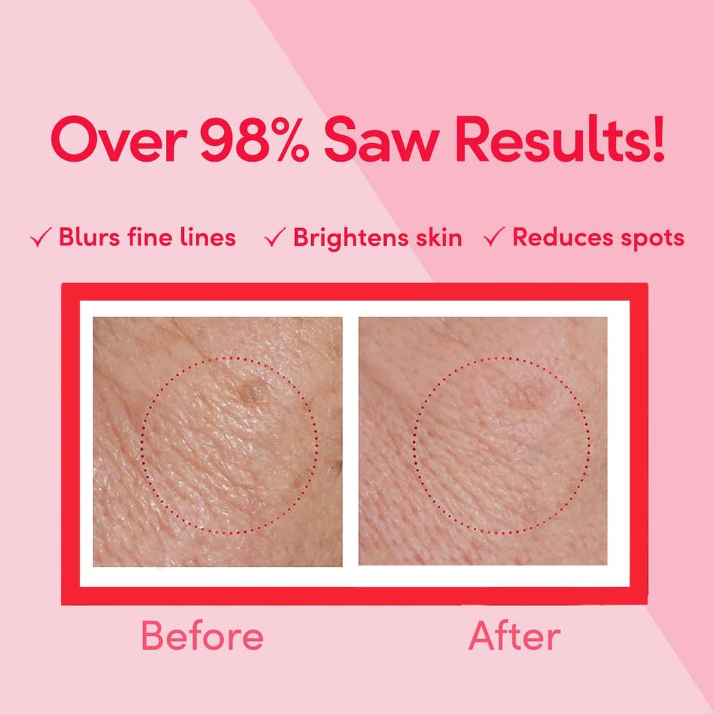 POND'S Дневной крем Age Miracle 50 г, SPF 18 PA++, антивозрастное легкое увлажняющее средство для лица для уменьшения линий и морщин — с ретинолом-C, витамином Е и ниацинамидом