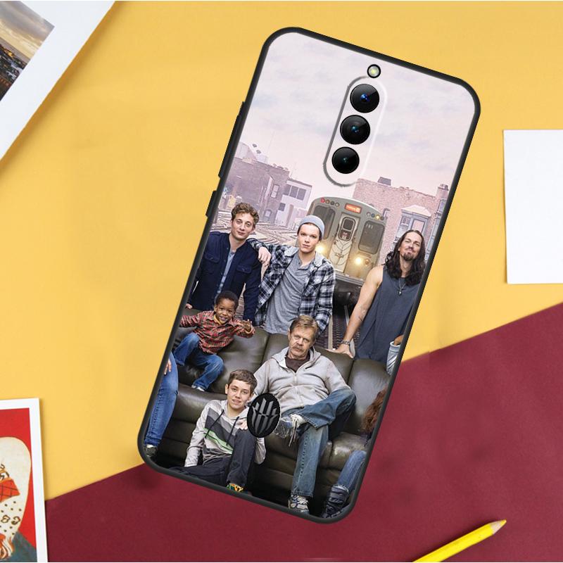 Lip Gallagher Shameless TV Show Case For ZTE Nubia Red Magic 10S Pro Plus 8 9 10 Air 8S 9S 11 Pro Plus 6 7 6S 7S Pro Cover