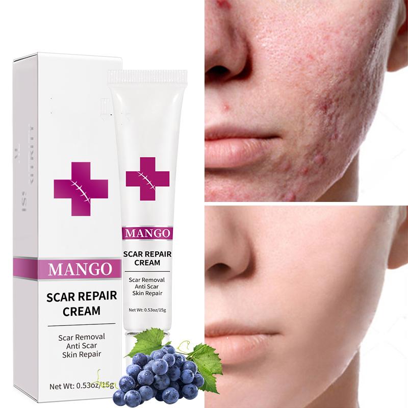 Нежная паста для удаления шрамов, восстанавливающий шрам, гель для уменьшения шрамов на коже, паста для уменьшения шрамов для всех типов кожи