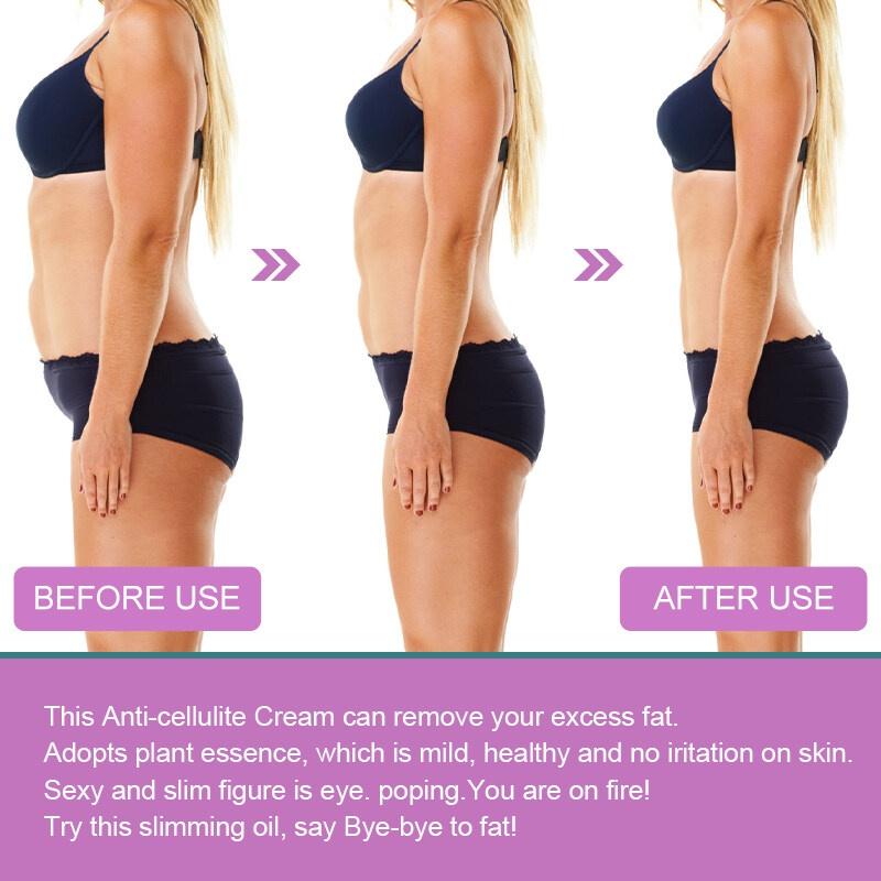 100% натуральные ингредиенты, крем для похудения для женщин и мужчин, укрепляющий крем, крем от целлюлита, имбирь для похудения и похудения для удаления целлюлита.