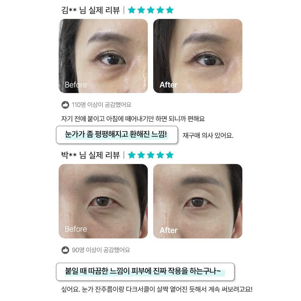 [Шард] Подтягивающий патч для зоны под глазами Eye Bag Lift 1100 капель, 1 упаковка