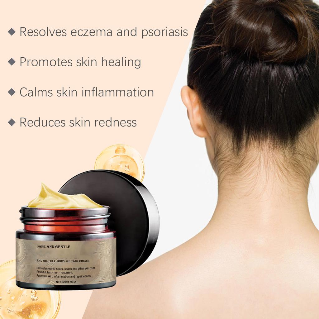 Крем для ухода за кожей для облегчения псориаза - банка 50 г от покраснения и раздражения