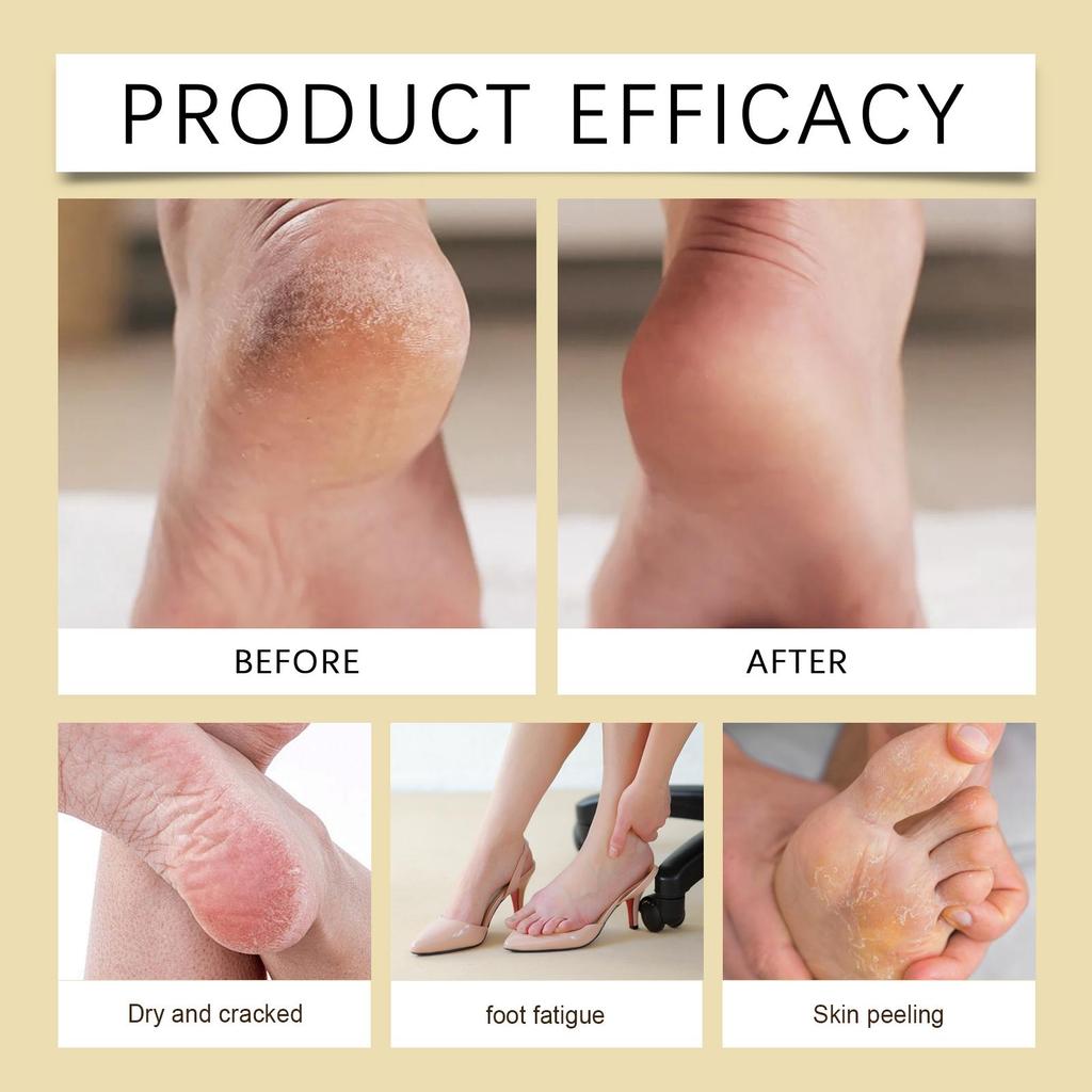 20 г Крем для ног против трещин Крем для восстановления потрескавшейся кожи Сухость Пятки с трещинами Шелушение Восстановление Маска для ног Питательный Смягчающий Увлажняющий Лосьон