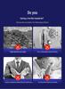 Перфорированная алюминиевая крышка для кондиционера для уличных общежитий