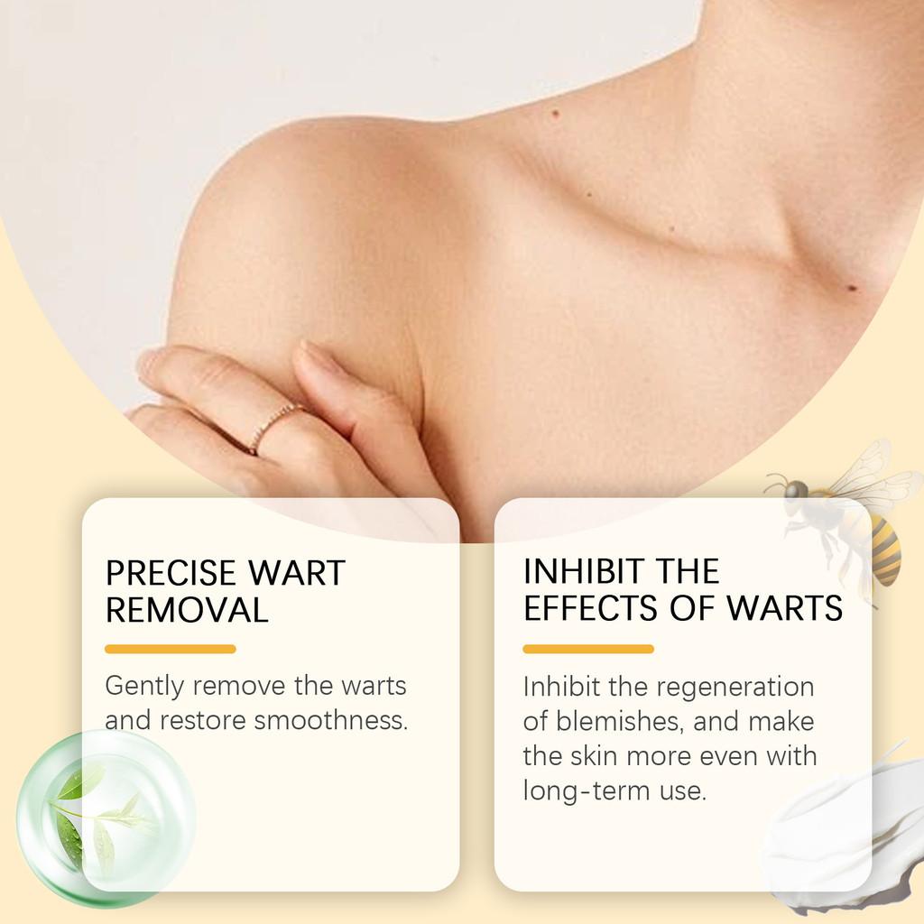 Крем для восстановления кожи Ximonth Herbal для мягкого удаления и питания кожных папиллом