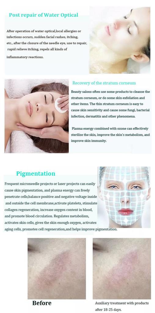 Professional Ozone Plasma Pen Machine for Alleviating Skin Aging Skin Rejuvenation Whitening Acne Treatment Plasma Pen