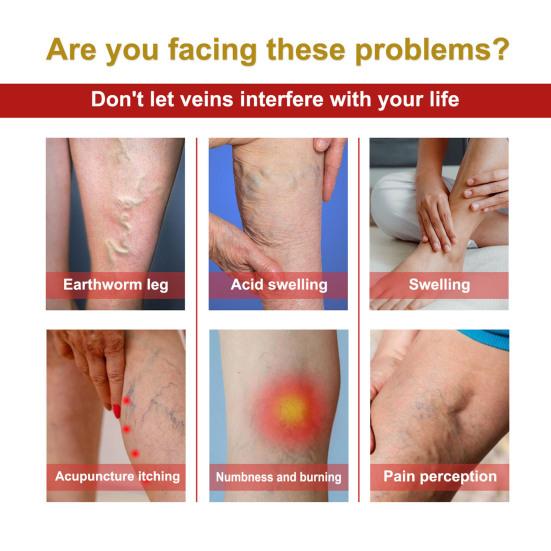 12Pcs/Bag Vessel Blockage Patch Moderate Effective Non-irritating Delicate Texture Eco-friendly Health Care Tool Portable Varicose Relief Care Patch