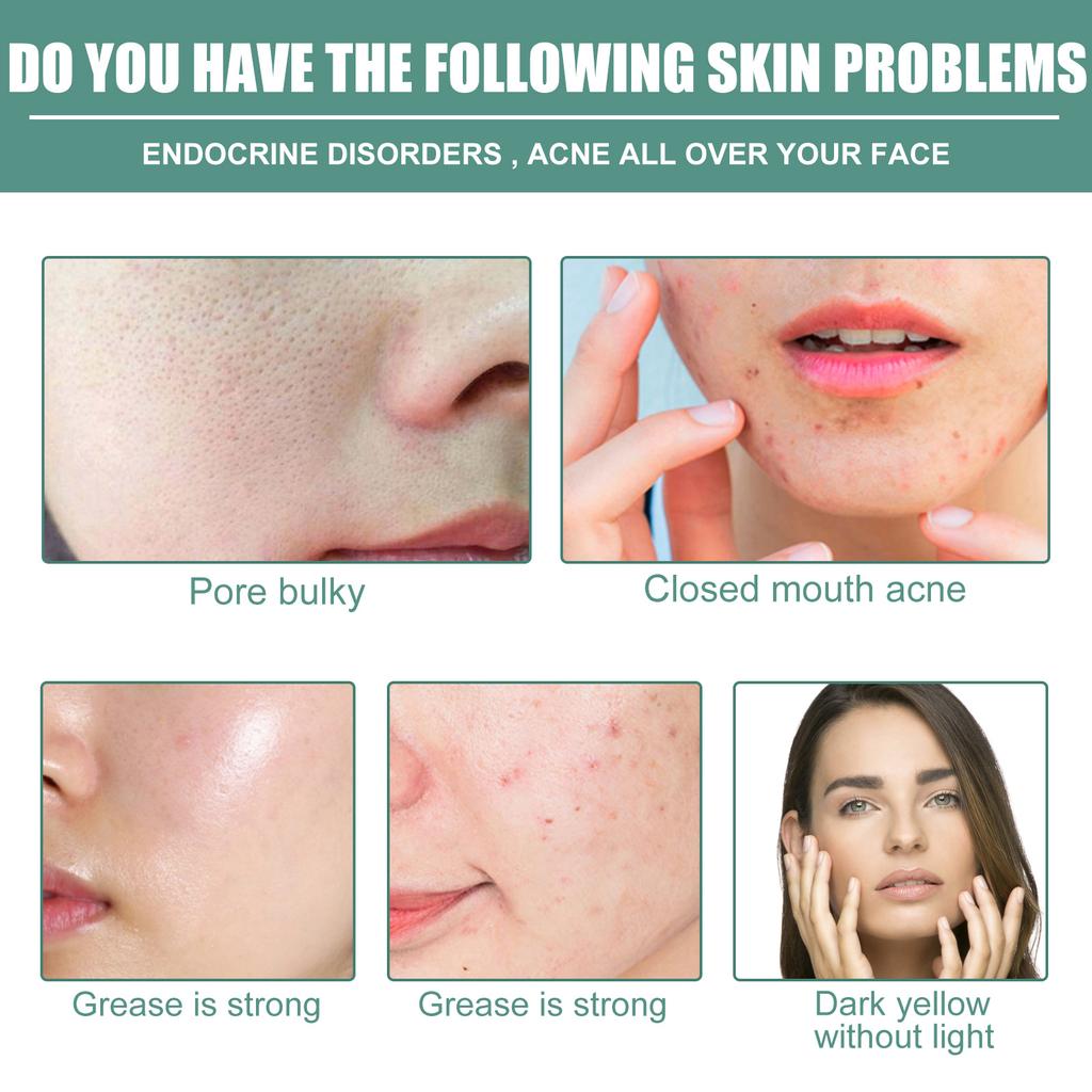 Экстракт ретинола, омолаживающее средство для сужения пор, разглаживает мелкие морщины, осветляет, укрепляет и освежает кожу лица