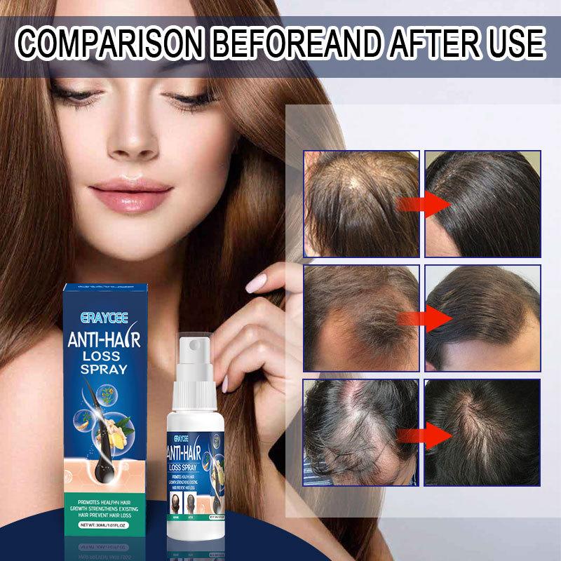 30ml Oil for Hair Growth Hair Hair Growth Vitamin E Serum Hair Vitamin Shine Serum Capsule Massage Oil