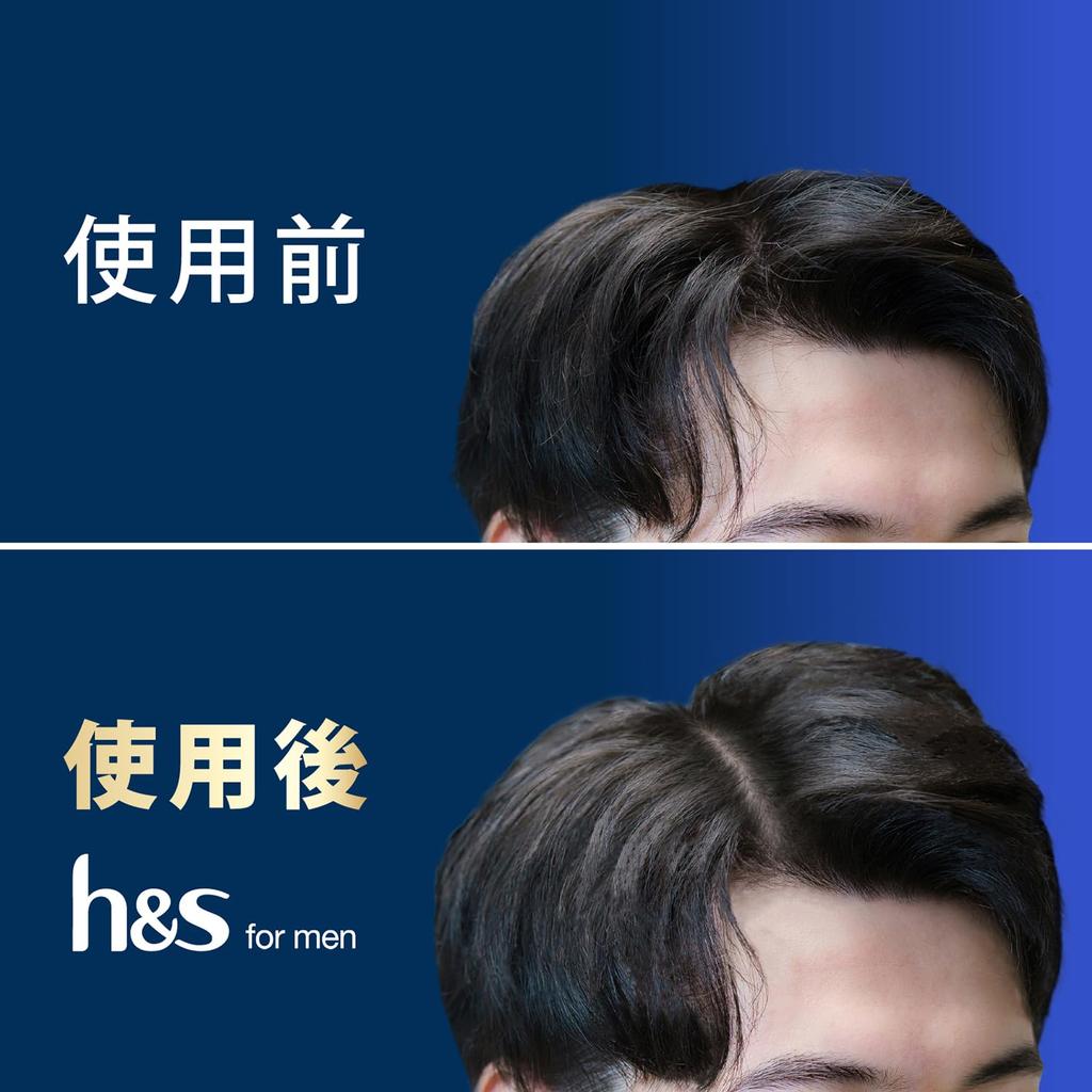 For Men Conditioner 900g Refill Extra Large Volume Up Treatment for Men H&s [3-pack] [Large Capacity] H&S