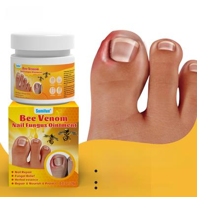 Мазь для лечения грибка ногтей Sumifun, крем для ухода за вросшим ногтем, 20 г