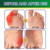 Natural Herbal Bunion Patch - Gentle Comfort for Toe Alignment