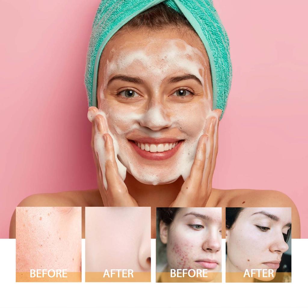 Turmeric Cleanser Deep Cleansing Brightens Skin Moisturizing Anti Wrinkle Fade Acne Scars and Blemishes Deep Nourishing Gentle Moisturizing SkinCare