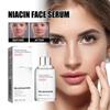 Niacin Facial Essence Fades Acne Marks Moisturizes Facial Treatment Serum Shrinks Pores, Whitens Skin Beautifies The Skin Face Essence Oil Skin Care