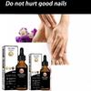 Nail Care Nail Cream Nail Nails Care Remove On The Fingers and Toenail