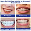 Набор стоматологических ортодонтических клеев Светоотверждаемый клей Металлические керамические брекеты Брекеты Невидимое крепление Стоматологические инструменты Материалы для стоматолога