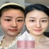 Gel Cream, Moisturizing, Whitening, Brightening, Repairing Damaged Skin, Even Skin Tone, Anti-aging Moisturizer