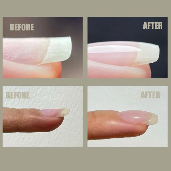 Советы по гелю для дизайна ногтей, расширяющиеся, мягкие, не раздражающие, удобные, простые в эксплуатации для женщин